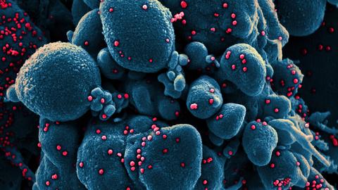 Auf dieser vom US-Forschungszentrum «National Institute of Allergy and Infectious Diseases» (NIAID) zur Verfügung gestellten Aufnahme vom 18.03.2020 ist eine Zelle (blau) schwer mit dem Coronavirus (SARS-CoV-2, rot) infiziert. Die Probe wurde von einem Patienten in den USA isoliert.