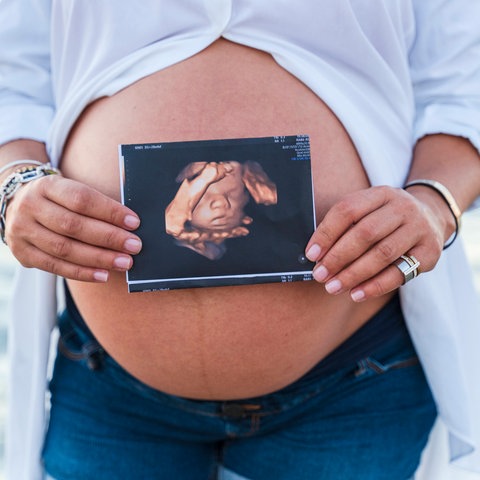 Schwangere hält ein Ultraschallbild